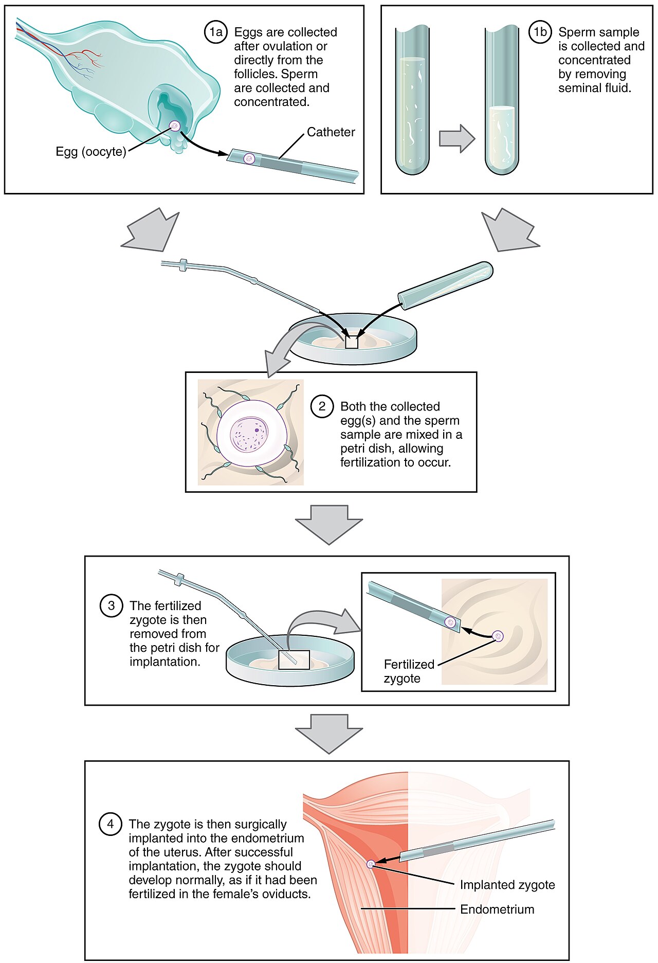 In-vitro-Fertilisation im Labor — 1978 kommt das erste Retortenbaby zur Welt